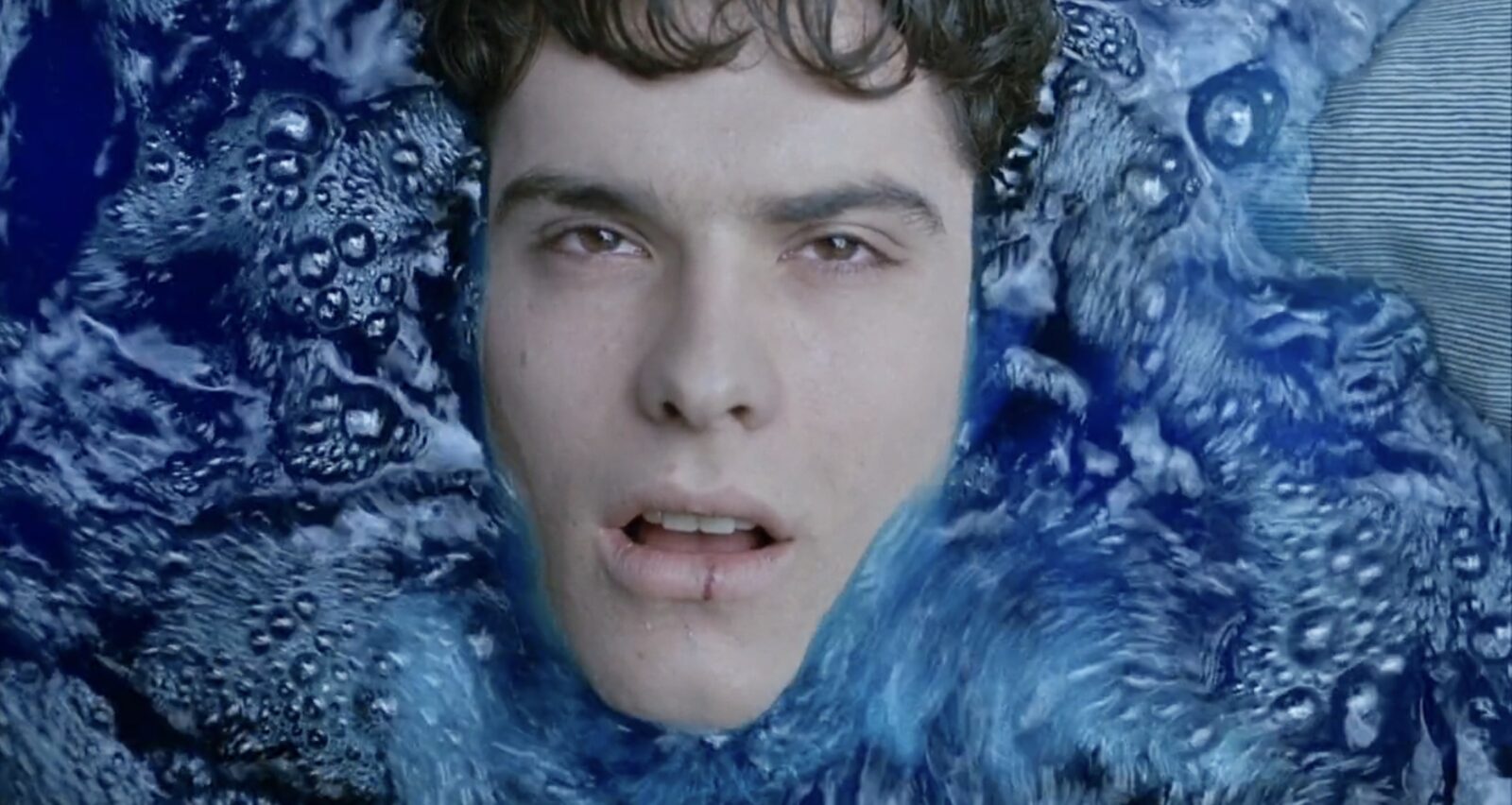 elmer remue meninges brain damage